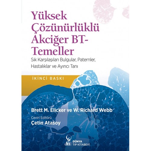 Yüksek Çözünürlüklü Akciğer BT-Temeller